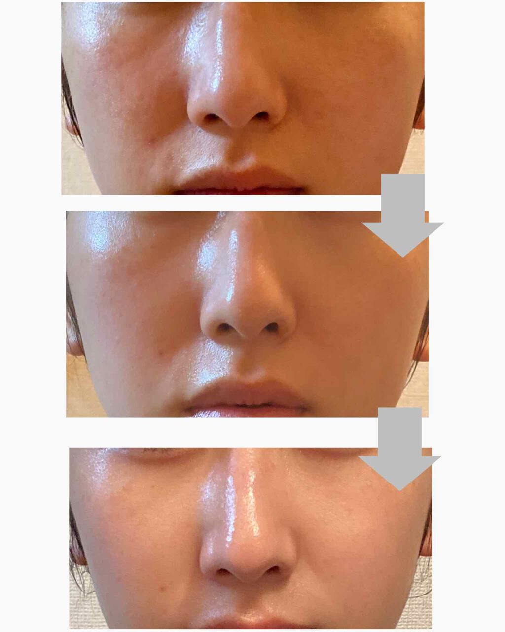 薬用しみ対策 保湿クリーム/メラノCC/フェイスクリームを使ったクチコミ(2枚目)