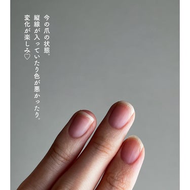 Dr.Nail ディープセラムのクチコミ「﹋﹋﹋﹋﹋﹋﹋﹋﹋﹋﹋
ディープセラム
3.3ml / ¥2,860（税込）

﹋﹋﹋﹋﹋﹋﹋.....」（3枚目）