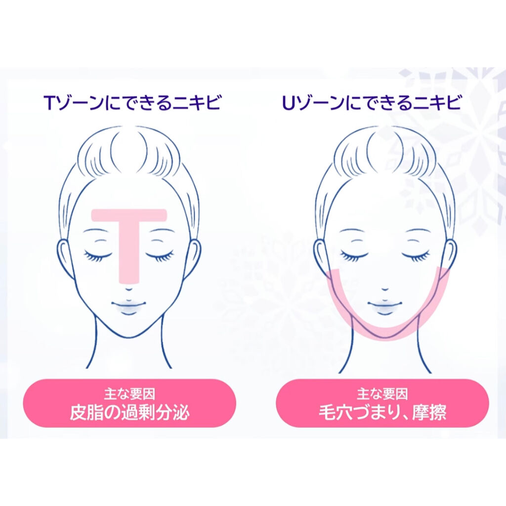 マキロン アクネージュ メディカルローション	（医薬品）/マキロン/その他を使ったクチコミ（2枚目）