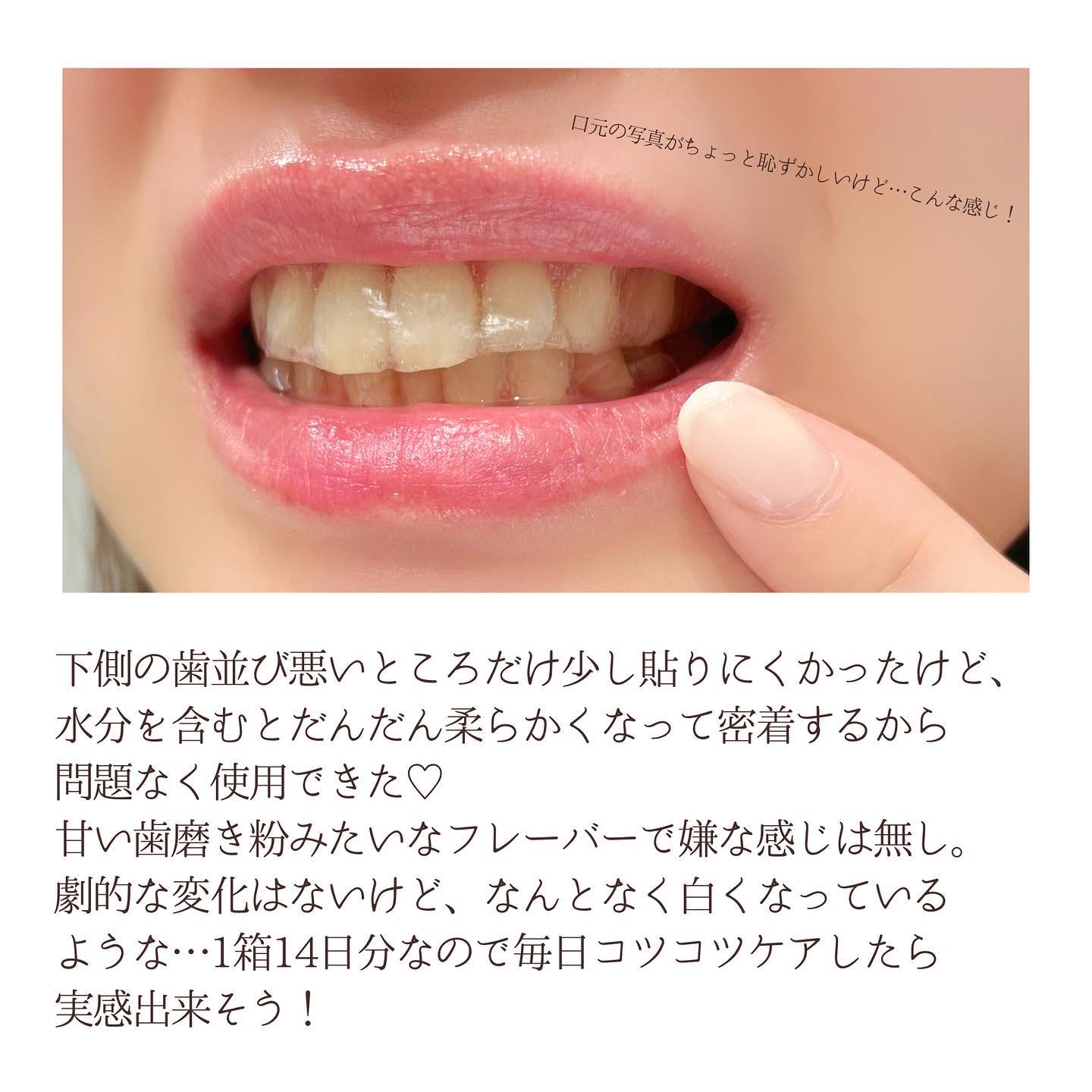 THE 歯の黄ばみ集中パック/武内製薬 THEシリーズ/その他オーラルケアを使ったクチコミ（3枚目）