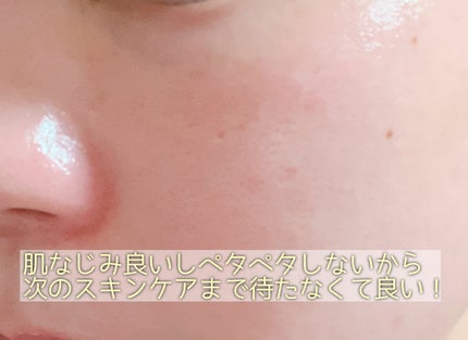 ファイン100/imini/美容液を使ったクチコミ(3枚目)