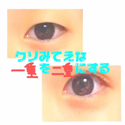 アイトーク スーパーホールド/アイトーク/二重まぶた用アイテムを使ったクチコミ(1枚目)