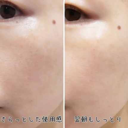 BHA CAPSULE NON COMEDO TONER/23years old/化粧水を使ったクチコミ(8枚目)