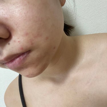 亜朱咲 on LIPS 「『肌断食』をして分かったこと💡肌断食をして日数が経ちました！肌..」（2枚目）