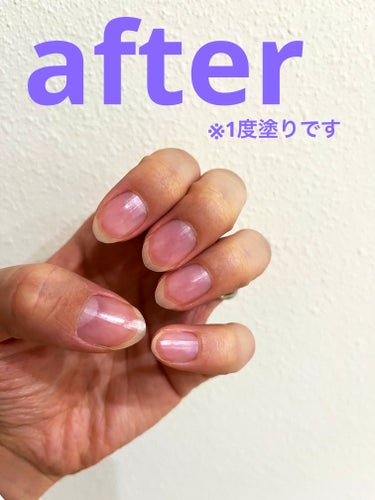 クイックケアコート/ettusais/ネイルオイル・トリートメントを使ったクチコミ（4枚目）