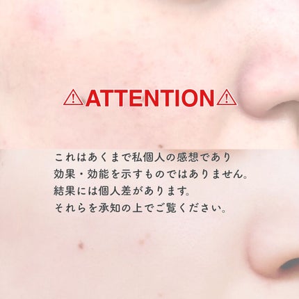 リンクル乳液 N/なめらか本舗/乳液を使ったクチコミ(3枚目)