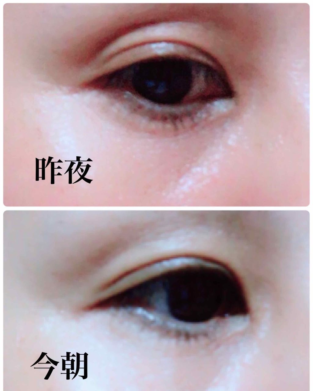 メルティングエッセンスマスク/Quanis/シートマスク・パックを使ったクチコミ（3枚目）