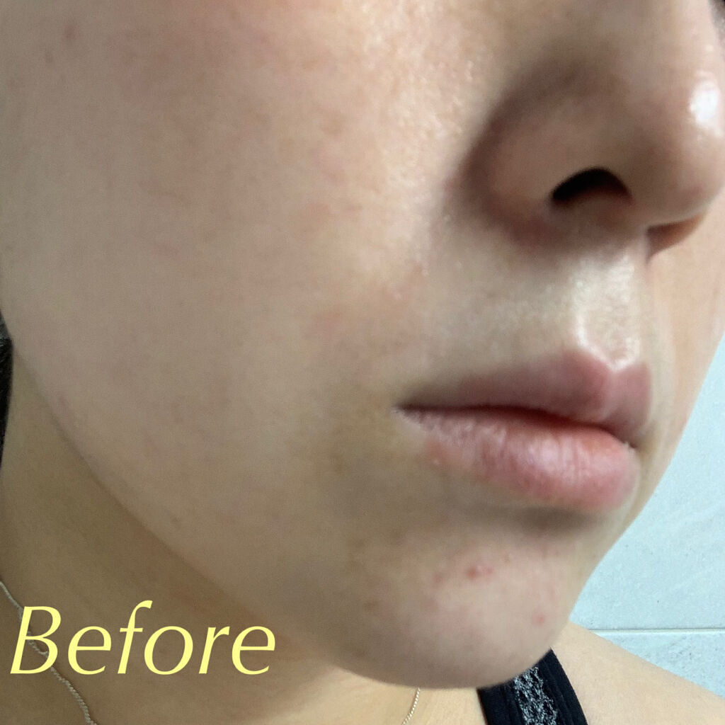 ピーチスキンフィッティングベース/espoir/化粧下地を使ったクチコミ（3枚目）