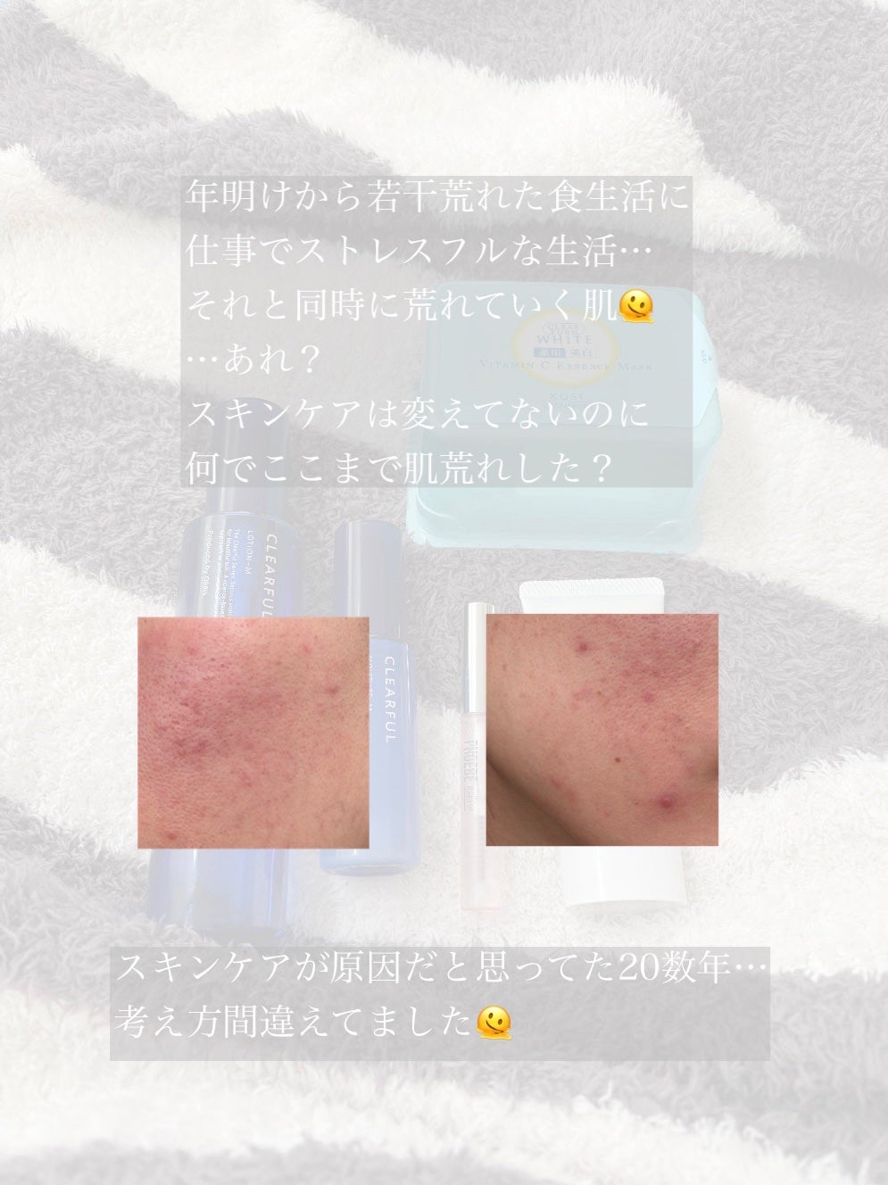 taru〻すっぴん綺麗になりたい2児ママ on LIPS 「🏷️アトピー肌🏷️花粉等の肌荒れ🏷️ニキビ20数年、肌トラブル..」(2枚目)