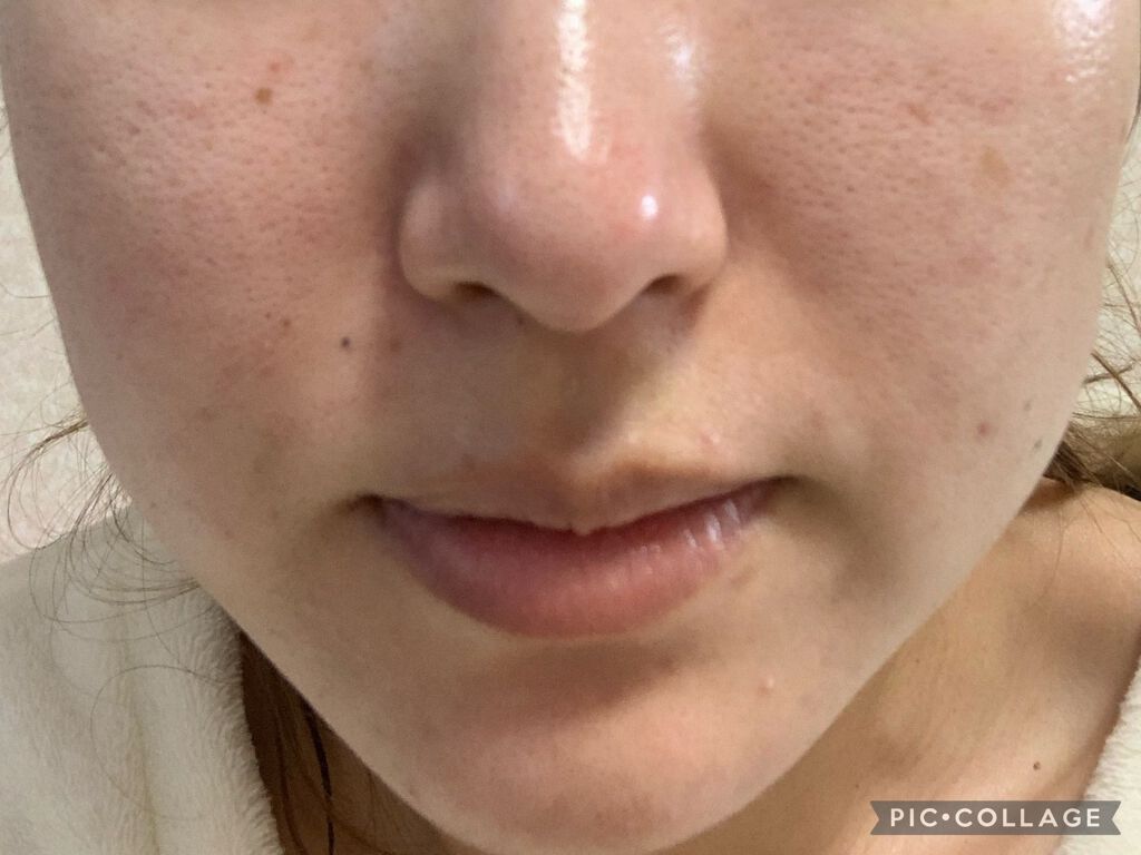 高品位「スクワラン」/HABA/フェイスオイルを使ったクチコミ(1枚目)