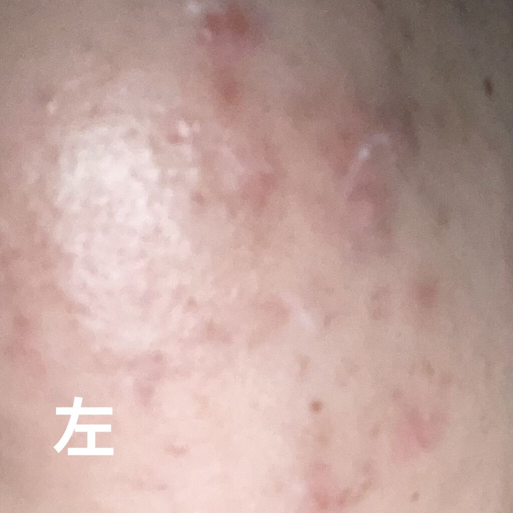 潤浸保湿 フェイスクリーム/キュレル/フェイスクリームを使ったクチコミ（1枚目）