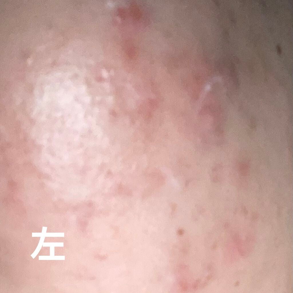 潤浸保湿 フェイスクリーム/キュレル/フェイスクリームを使ったクチコミ(1枚目)