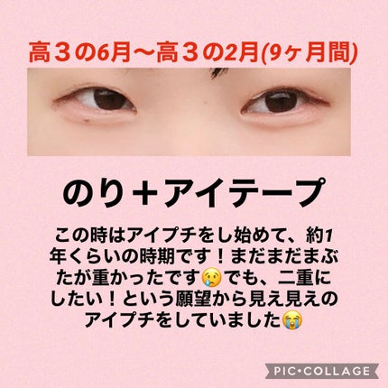 アイビューティー フィクサー WP/アストレア ヴィルゴ/二重まぶた用アイテムを使ったクチコミ(3枚目)