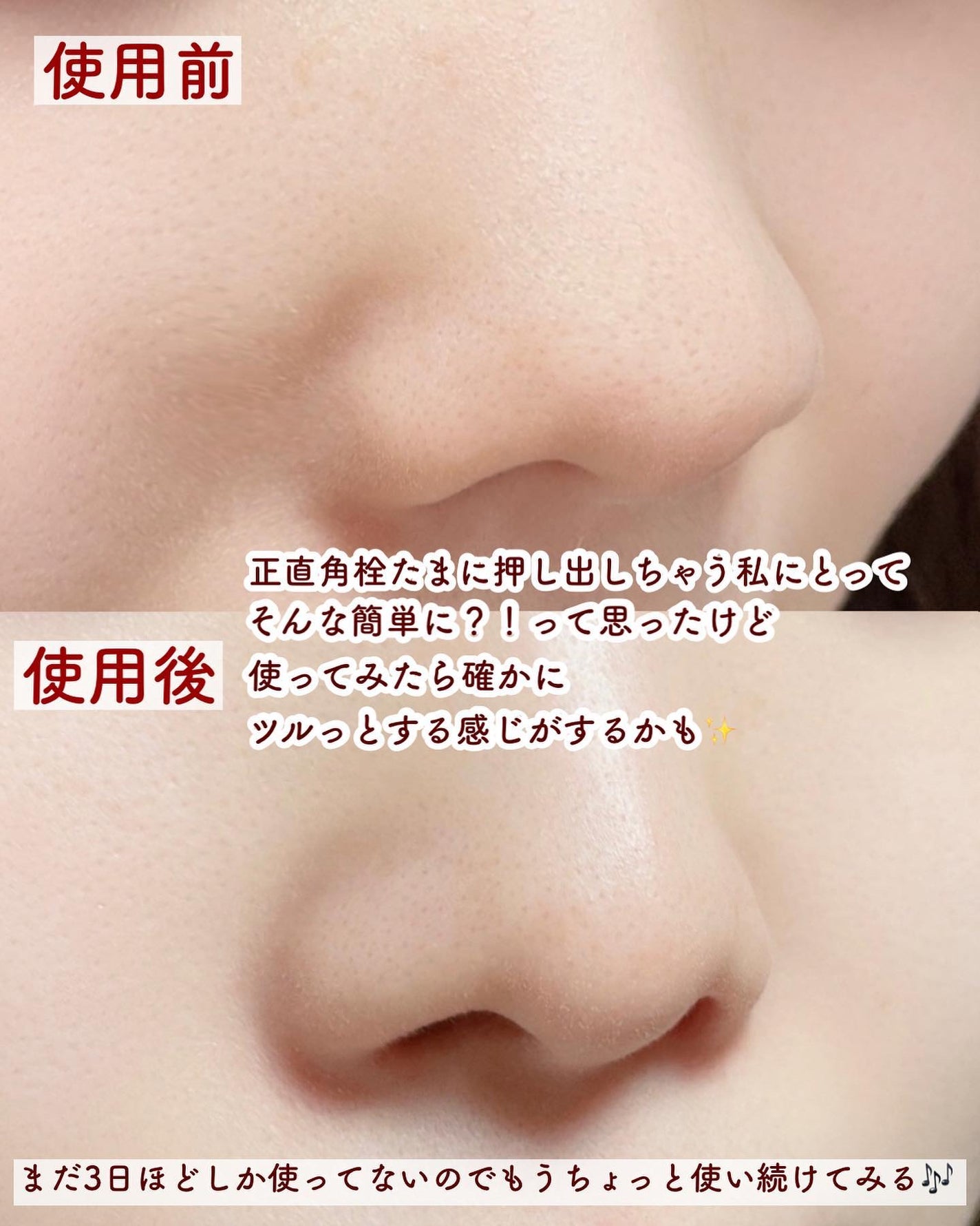 ケアナボン ひたし洗い液/小林製薬/その他スキンケアを使ったクチコミ(5枚目)