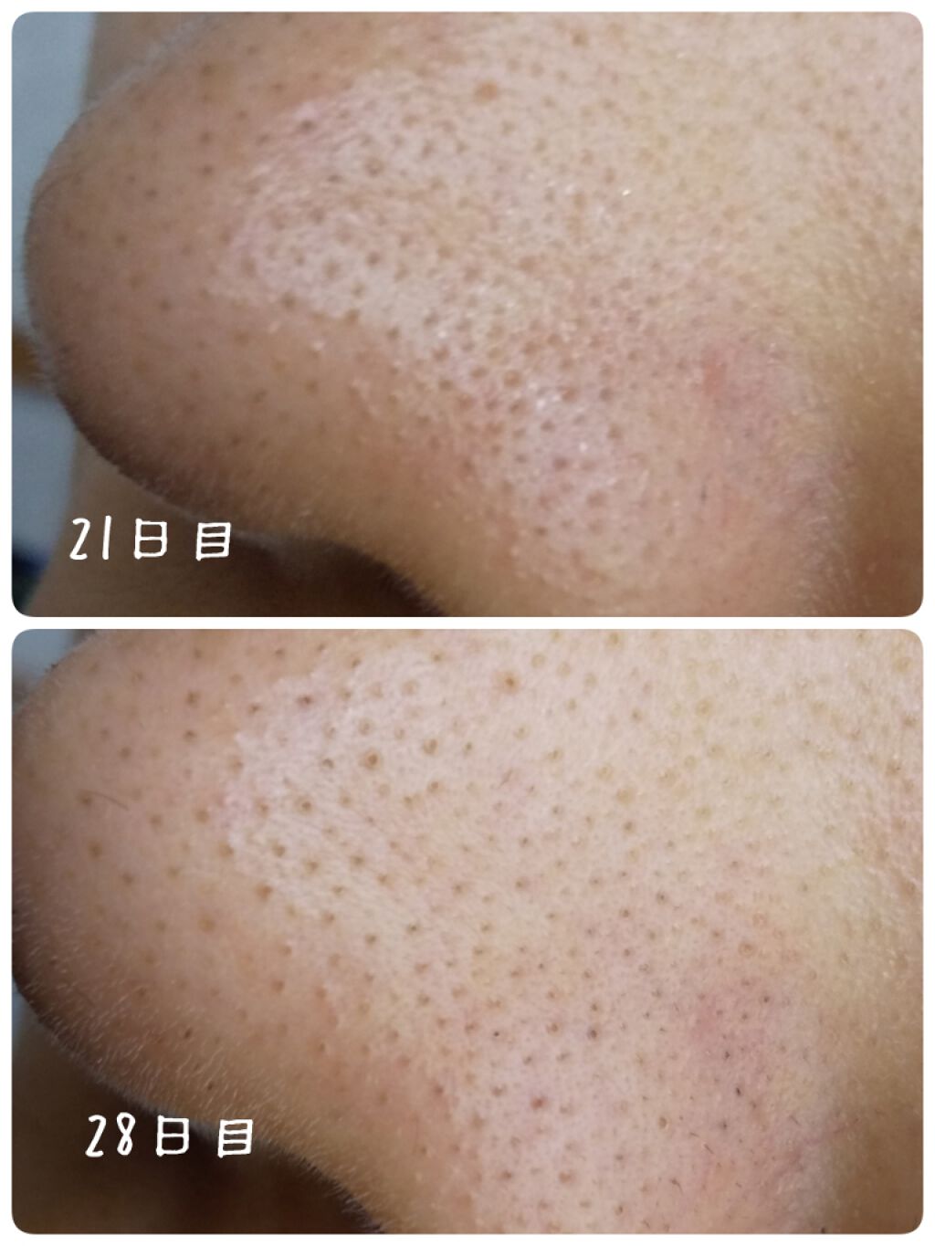 ホホバオイル/無印良品/ボディオイルを使ったクチコミ（3枚目）