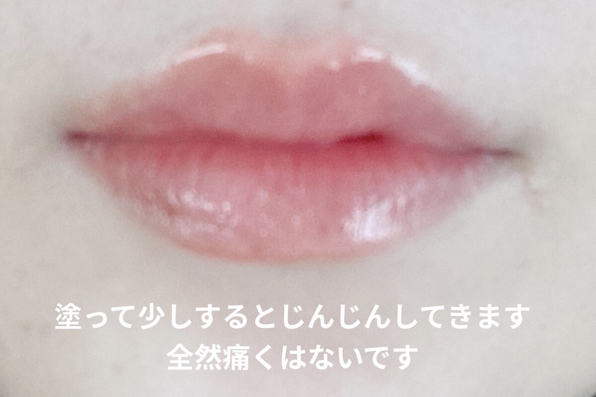 ドトムリッププラスプランパー 03 スプリングダーリン(SPRING DARLING)/keybo/リッププランパーを使ったクチコミ（2枚目）