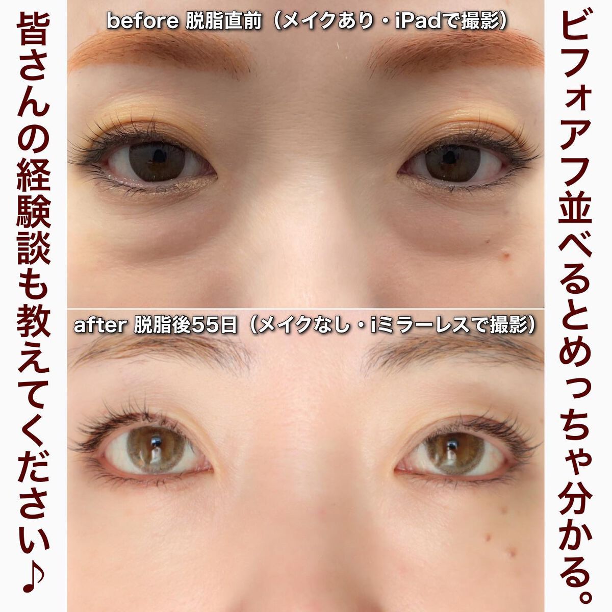 ããðå
çŸå®¹éšå¡ on LIPS ããè±èãã«ã€ããŠããã£ãšãŸãšããŸããðãã£ãŠã¿ãŠäœãããæã£ã..ãïŒ1æç®ïŒ