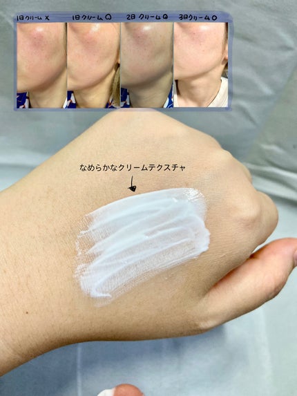 シカプラスト ボーム B5【海外版】/LA ROCHE POSAY(海外)/フェイスクリームを使ったクチコミ(3枚目)