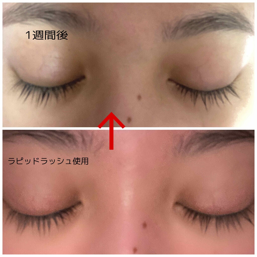 ラピッドラッシュ(R) 日本仕様正規品/ベリタス/まつげ美容液を使ったクチコミ(2枚目)