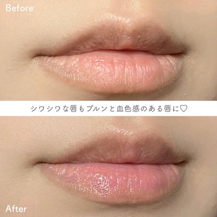 フラルネ リップバー/ALBION/リップ美容液を使ったクチコミ(4枚目)