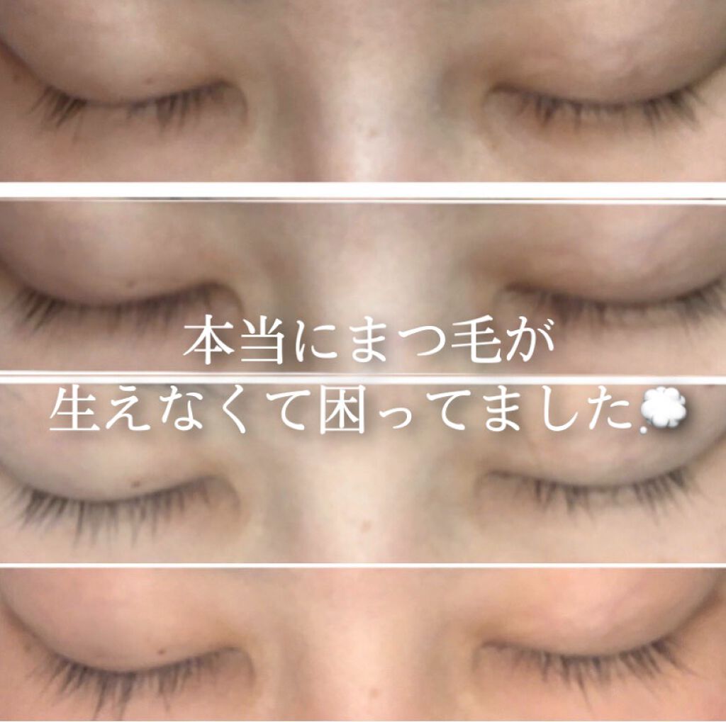 グラッシュビスタ/グラッシュビスタ/まつげ美容液を使ったクチコミ（1枚目）