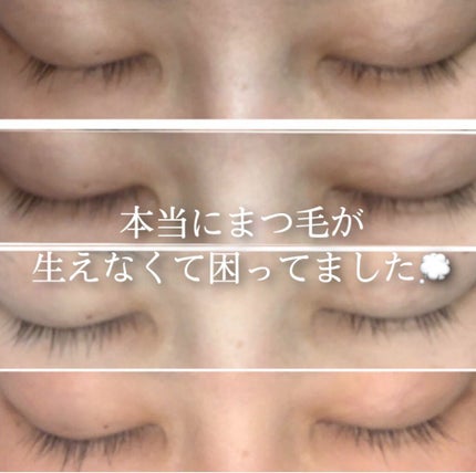 yukka on LIPS 「【まつ毛が生えてこない悩み💭】皆さんこんにちは🌞ご覧頂きありが..」(1枚目)