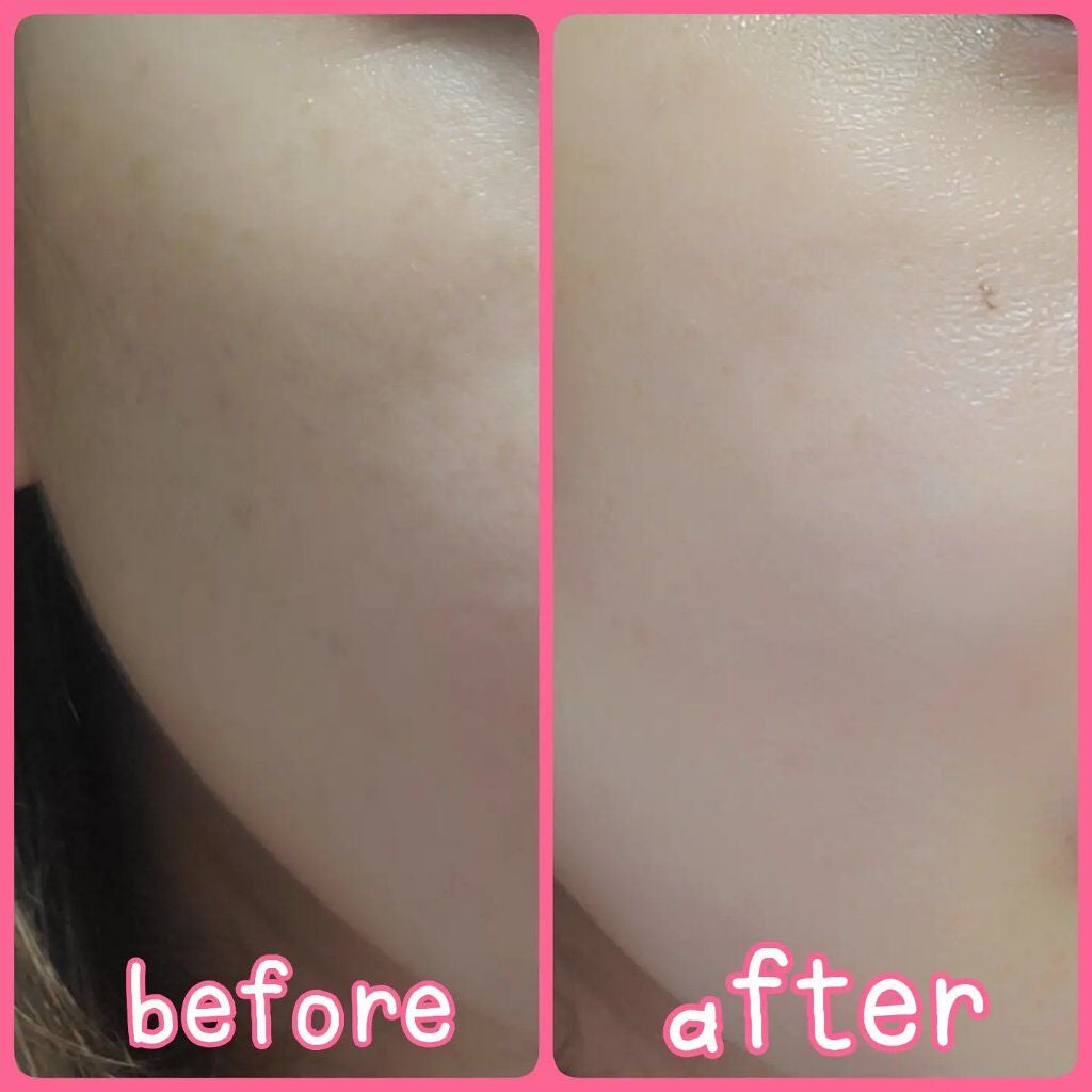 SIWA-KC オールインワンクッション/ハーブ健康本舗/クッションファンデーションを使ったクチコミ(3枚目)