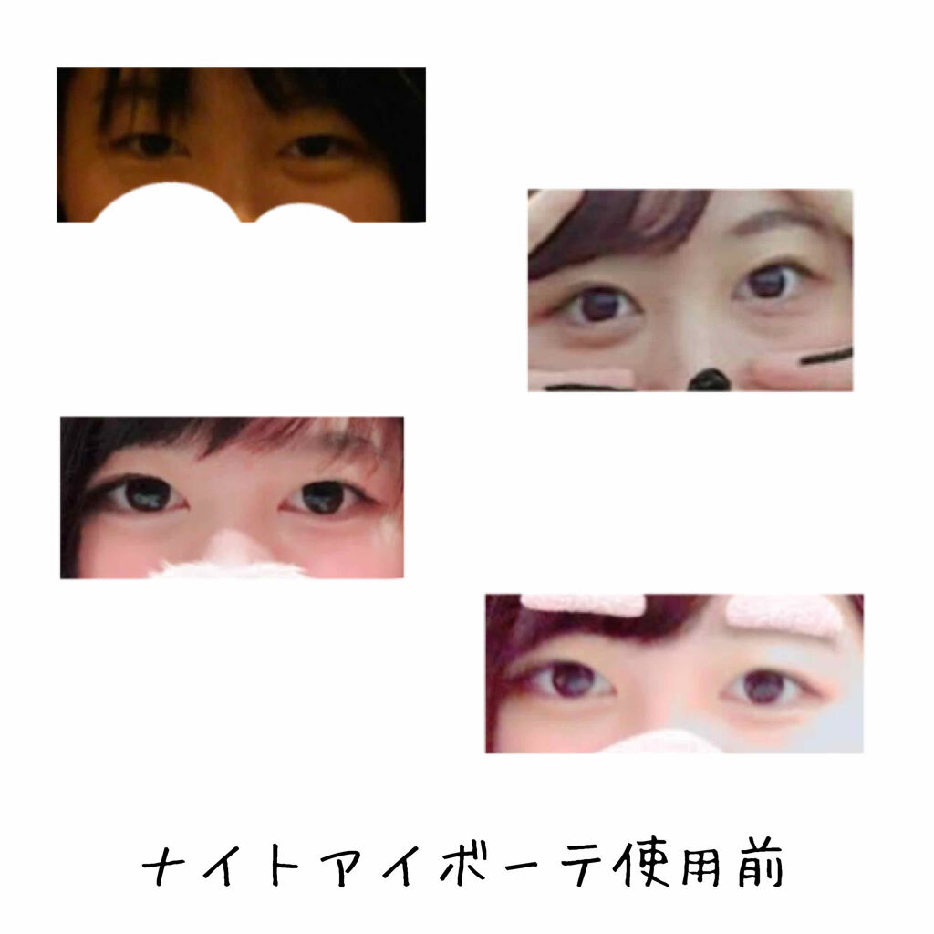 ナイトアイボーテ/StreeTrend/二重まぶた用アイテムを使ったクチコミ（2枚目）