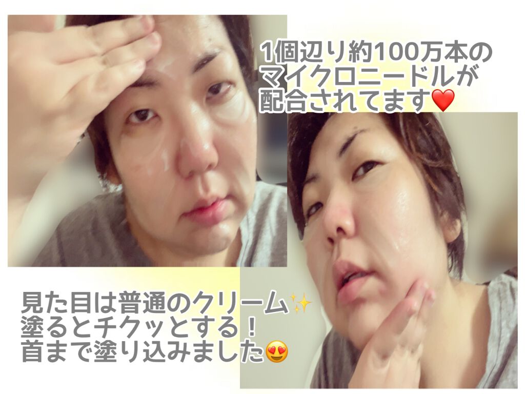 メディリフト ニードルリフトクリーム/YA-MAN TOKYO JAPAN/フェイスクリームを使ったクチコミ（3枚目）