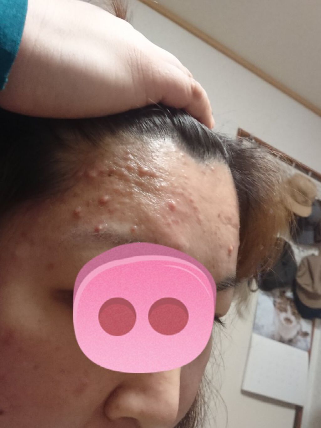 スチーマー ナノケア EH-SA37/Panasonic/美顔器・マッサージを使ったクチコミ（2枚目）