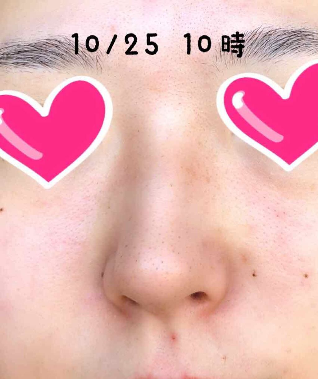 ロゼットゴマージュ/ロゼット/ピーリングを使ったクチコミ(3枚目)