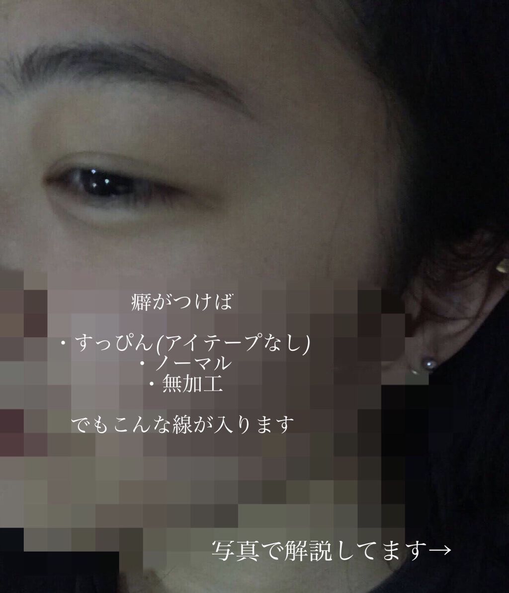 二重まぶた用シール/DAISO/二重まぶた用アイテムを使ったクチコミ（3枚目）