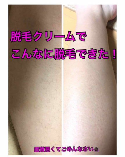 除毛クリーム(敏感肌用)/Veet/除毛クリームを使ったクチコミ(1枚目)