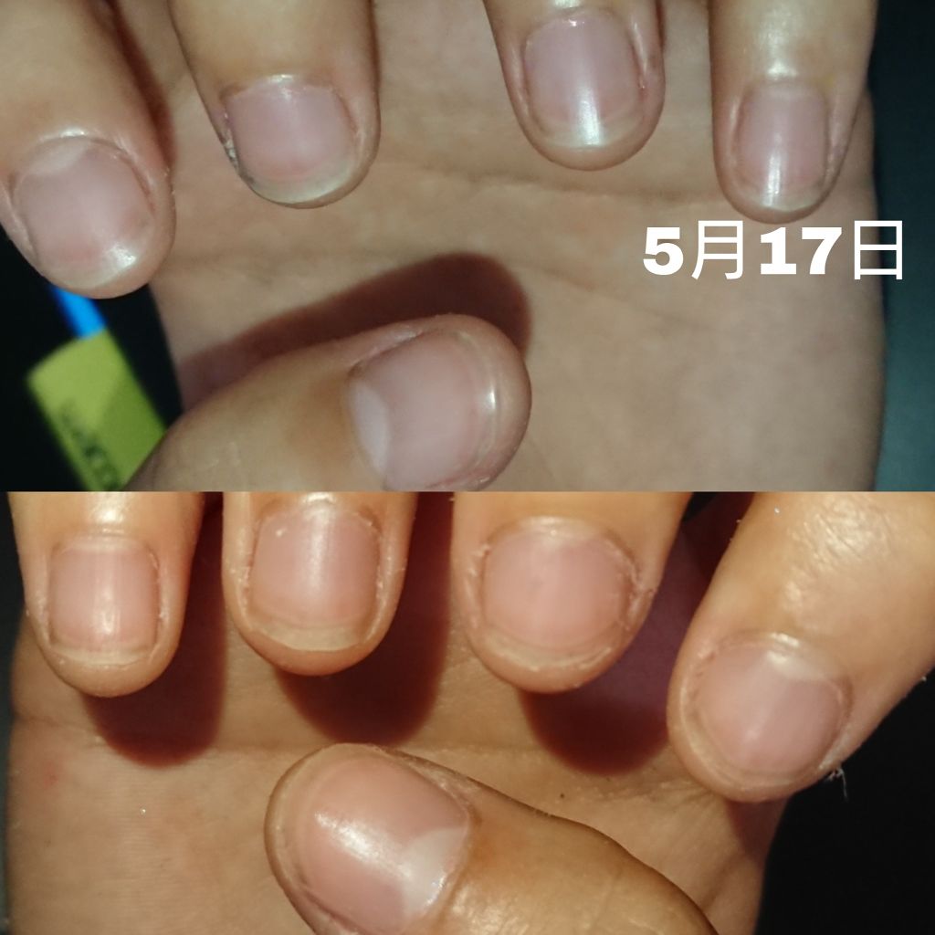 ネイルトリートメントオイル/カントリー&ストリーム/ネイルオイル・トリートメントを使ったクチコミ(3枚目)