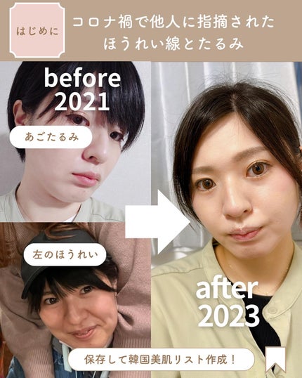 アンチリンクルエフェクトアンプルオリジン/MIGUHARA/美容液を使ったクチコミ(2枚目)