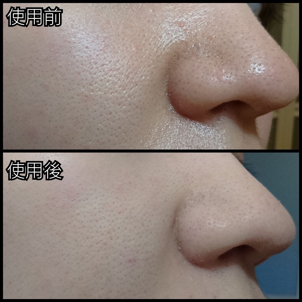 フラットスキンメーカー N/インテグレート/リキッドファンデーションを使ったクチコミ（3枚目）