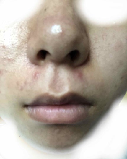 林 on LIPS 「初めまして!初投稿です…画像を見て不快になられた方もいると思い..」(4枚目)