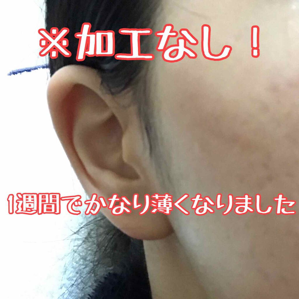 ビタミンC「2000」（医薬品）/武田薬品工業/健康サプリメントを使ったクチコミ（3枚目）