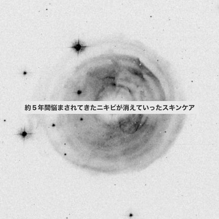 薬用石鹸 ミューズ(固形)/ミューズ/ボディ石鹸を使ったクチコミ(1枚目)