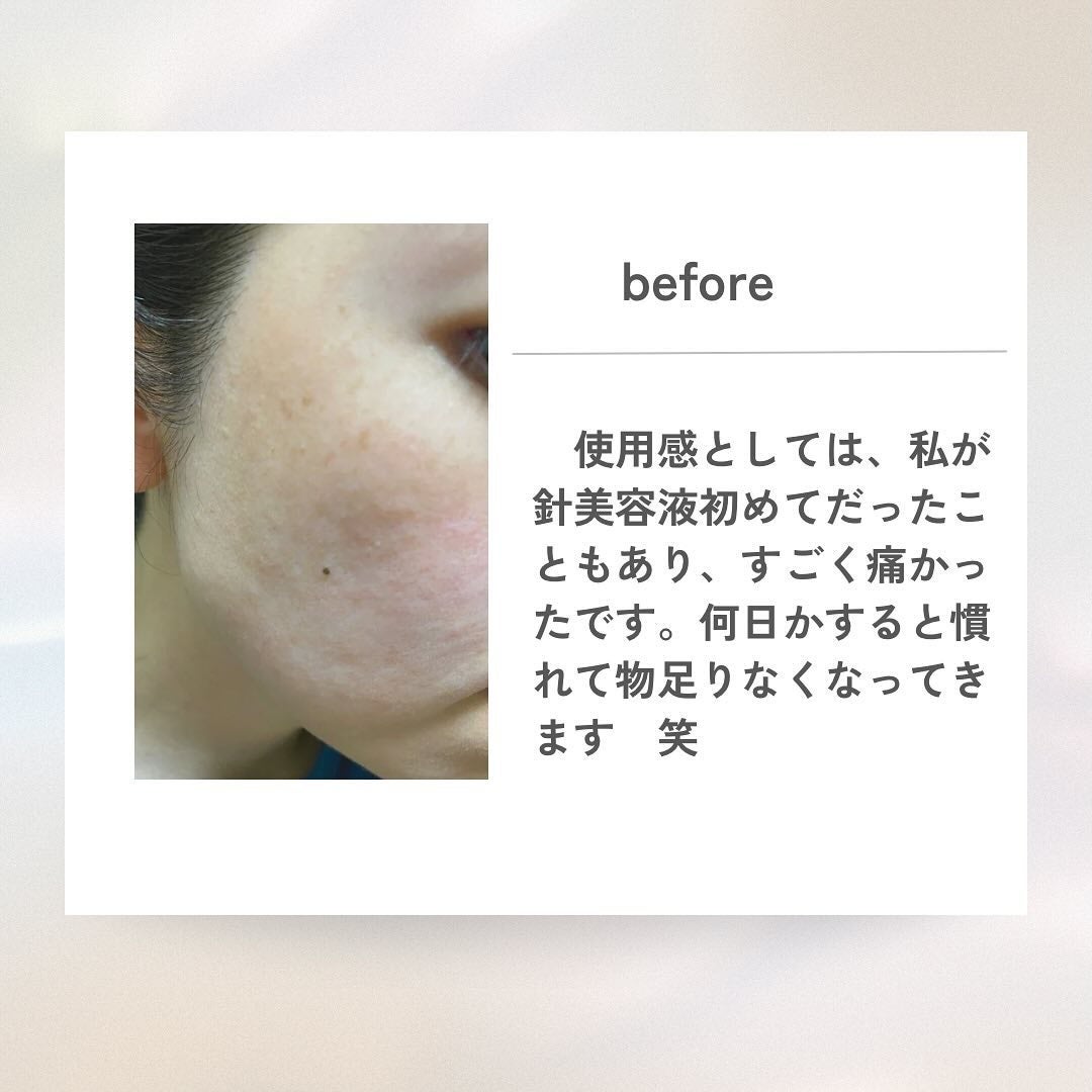 パンテショット675/COSNORI/美容液を使ったクチコミ(4枚目)