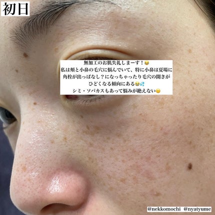 3番 集中ケアレチノール美容液/numbuzin/美容液を使ったクチコミ(3枚目)