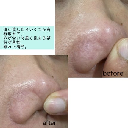 ソフィーナ iP ポア クリアリング ジェル ウォッシュ/SOFINA iP/その他洗顔料を使ったクチコミ(5枚目)