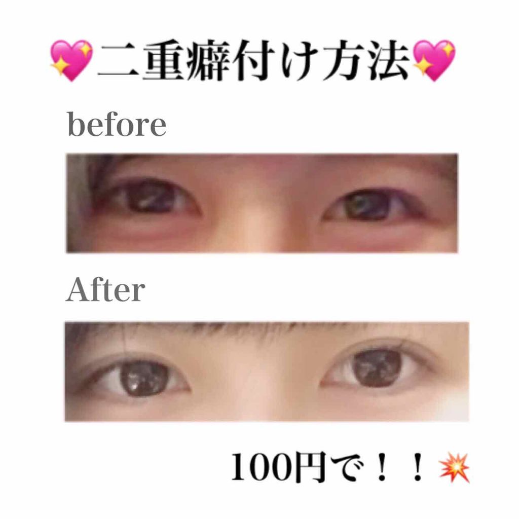 防水透明バン/DAISO/その他を使ったクチコミ(1枚目)