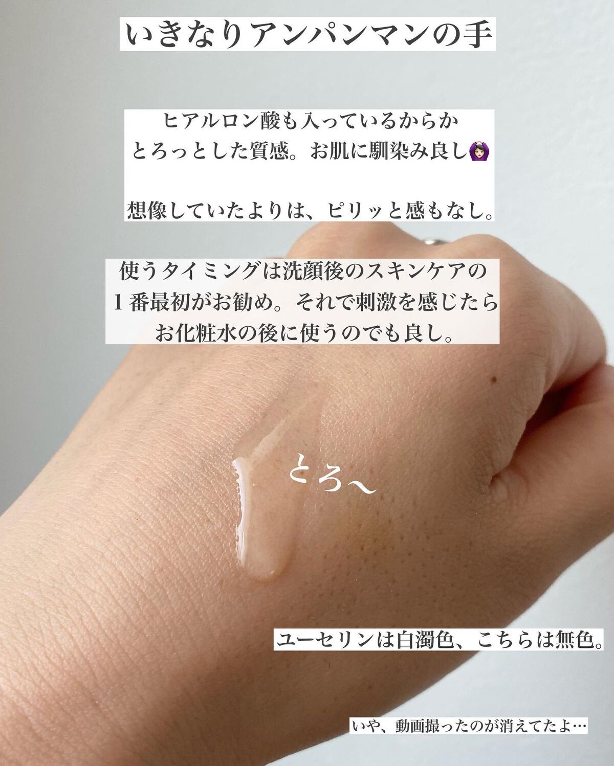 Rieðããªçºã®ã³ã¹ã¡æ
å ± on LIPS ãã¹ãã€ã³ã®ç®èç§å»æšå¥šãã©ã³ãïŒãã¥ã¢ãã¿ãã³C15%éäžã±..ãïŒ7æç®ïŒ