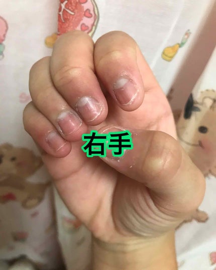 を使ったクチコミ(2枚目)
