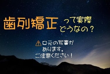 元ドブスです。歯列矯正をして、ドブス→普通へと格上げされました。今回は、歯列矯正の体験をお伝え出来たらな、と思います。(見苦しい写真があり申し訳ありません。気分を害された方、すみません。)

まず、2枚