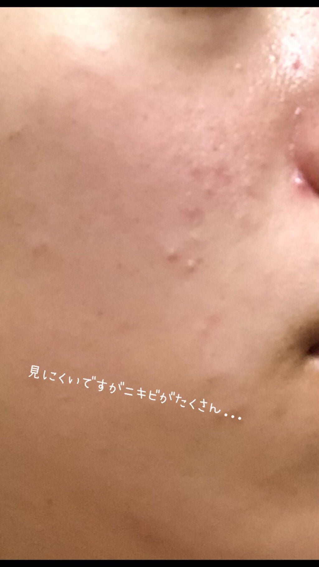 真琴 on LIPS 「初投稿です!変なところがあるかもしれませんが温かく見守ってくだ..」(2枚目)