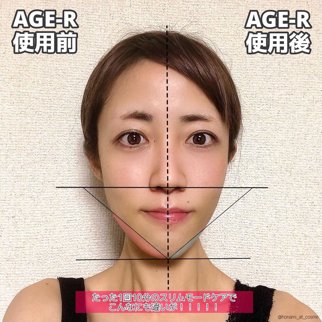 AGE-R専用ジェルセラム/MEDICUBE/美容液を使ったクチコミ(5枚目)