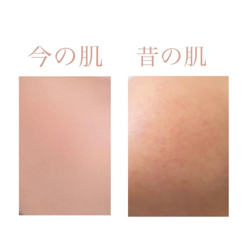 Yuichano☁️ on LIPS 「#マシュマロ肌の作り方私が昔の汚い肌から今の肌になったまでに使..」(1枚目)