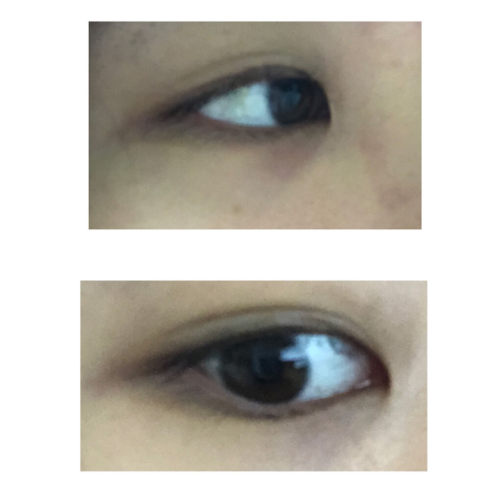 TWOOLダブルアイリッドハイブリットフィルム/SHOBIDO/二重まぶた用アイテムを使ったクチコミ（1枚目）